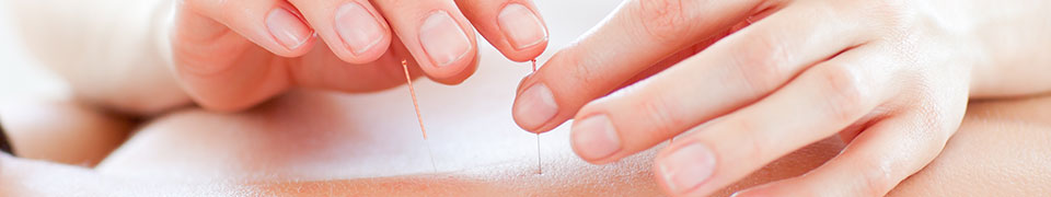 Acupuncture